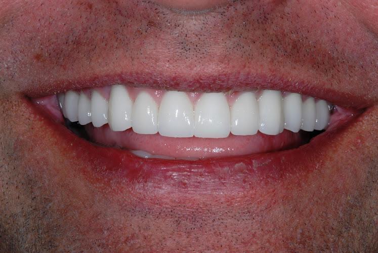 Negocio Texas Center For Cosmetic Dentistry, Dr. Guy Lewis And Dr. Teddy