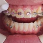 Texas Smiles Dental Center Cosmetic Dentist in San Antonio