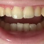 The Bilski Dental Group Cosmetic Dentist in Independence