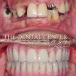 The Dental Center Of Manchester Cosmetic Dentist in Manchester