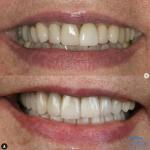 The Hills Dental Spa - Tmj & Cosmetic Dentistry Cosmetic Dentist in Austin