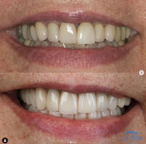 Negocio The Hills Dental Spa - Tmj & Cosmetic Dentistry