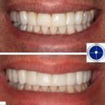 The Smilist Dental - Hoboken Cosmetic Dentist in Hoboken