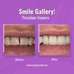 Thomas Smile Designs Cosmetic Dentist in Billings