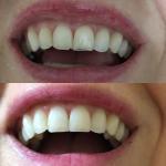 V2 Dentistry Cosmetic Dentist in Keizer