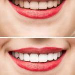 W. Gregory Rose Dds, Pa Cosmetic Dentist in San Gabriel Area