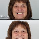 Westar Dental - Westerville Cosmetic Dentist in Westerville
