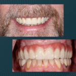 Windham Cosmetic Dentistry & Implant Center Cosmetic Dentist in Windham