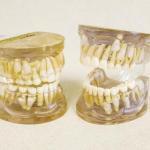 Yellowstone Orthodontics Cosmetic Dentist in Bozeman